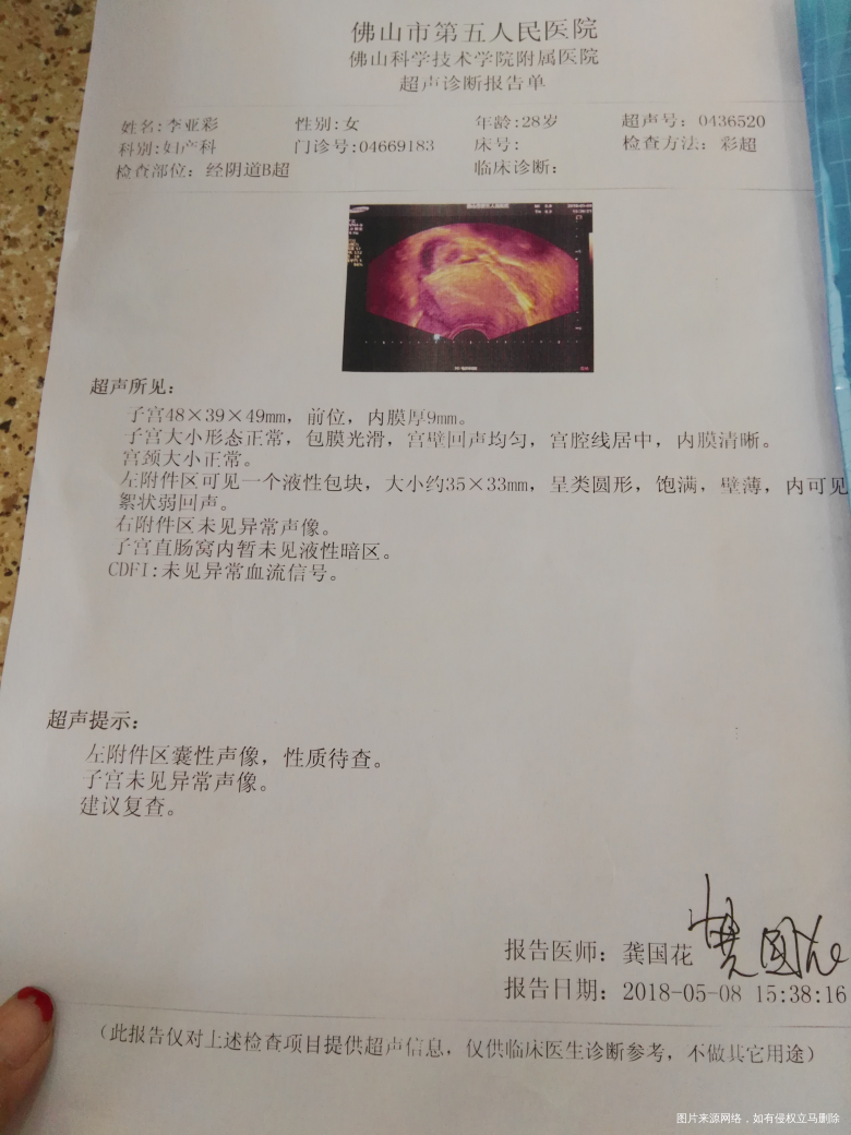 请医生帮忙看看B超单,