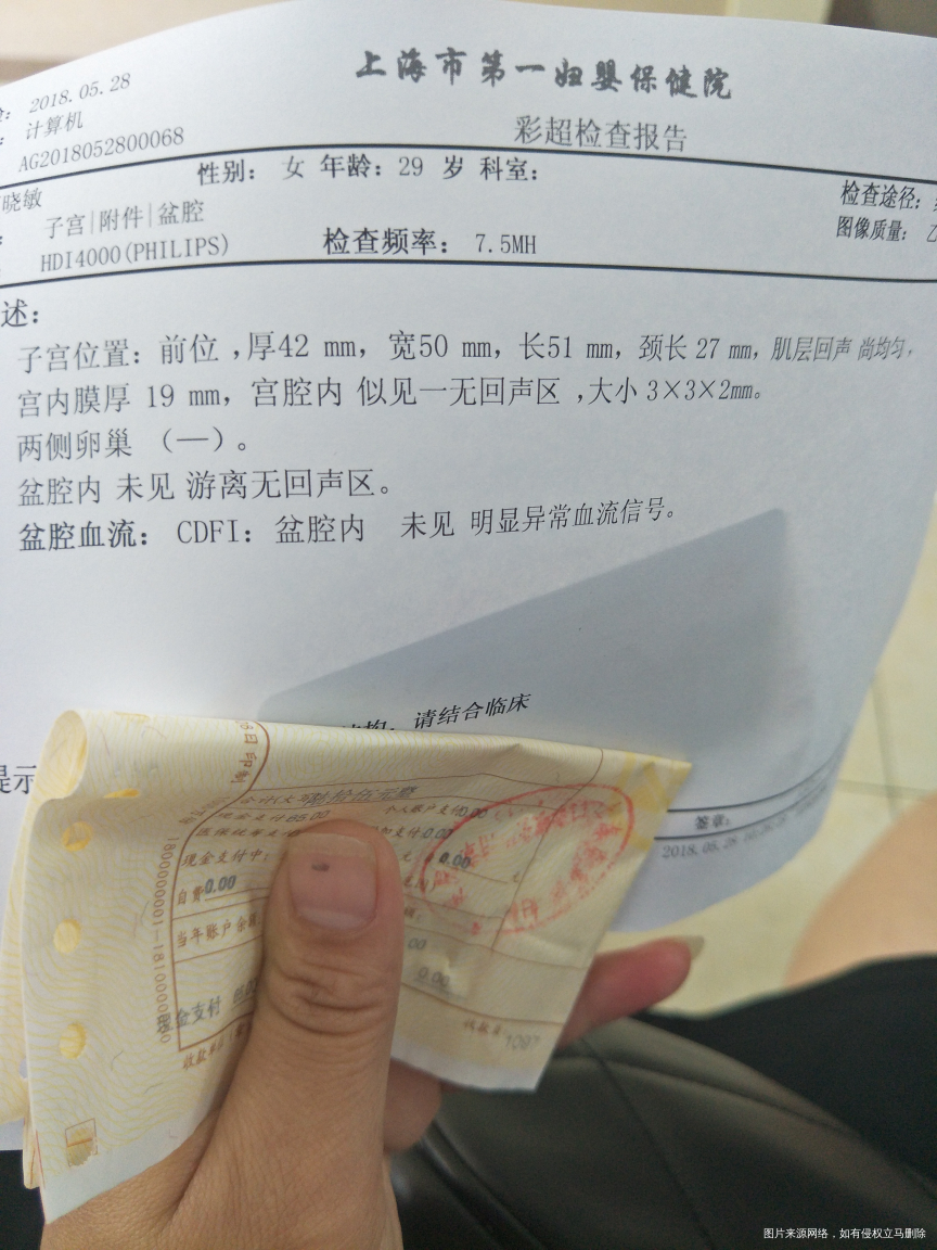 医生帮我看看阴超单,谢谢