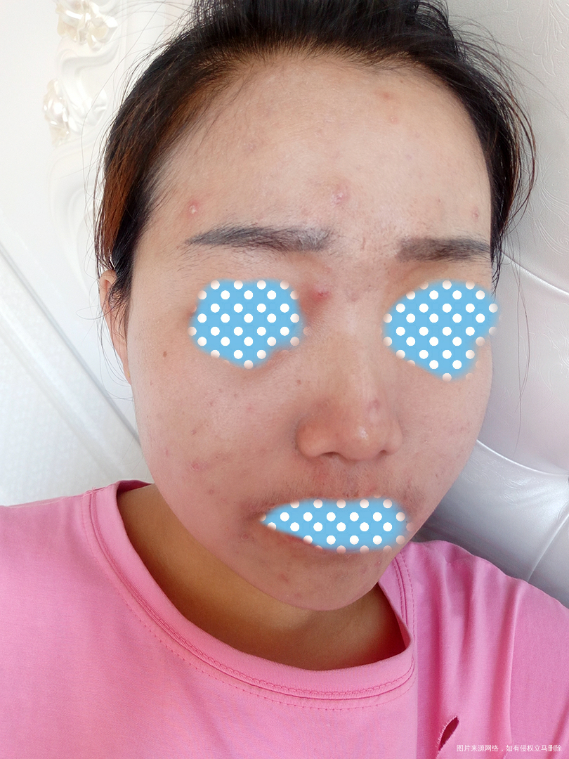 脸被毁了容,我该怎么办?