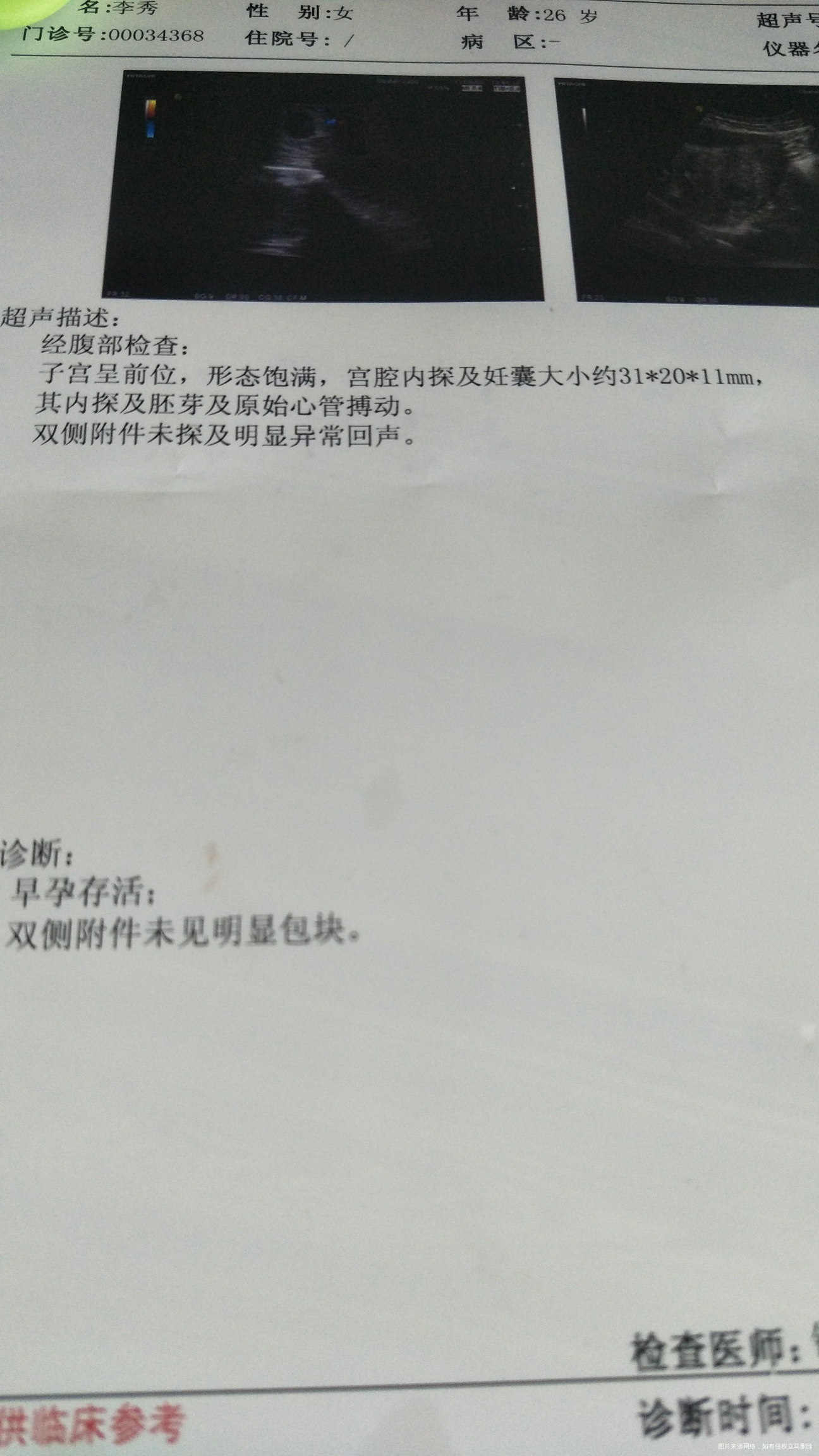 昨晚肚子疼,上个厕所之后就好多了,现在也不疼了