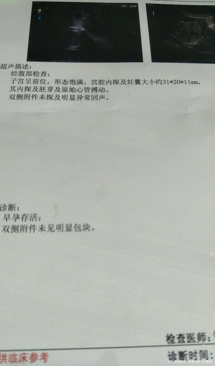 这是8月5号的B超单子,医生帮看下几周了