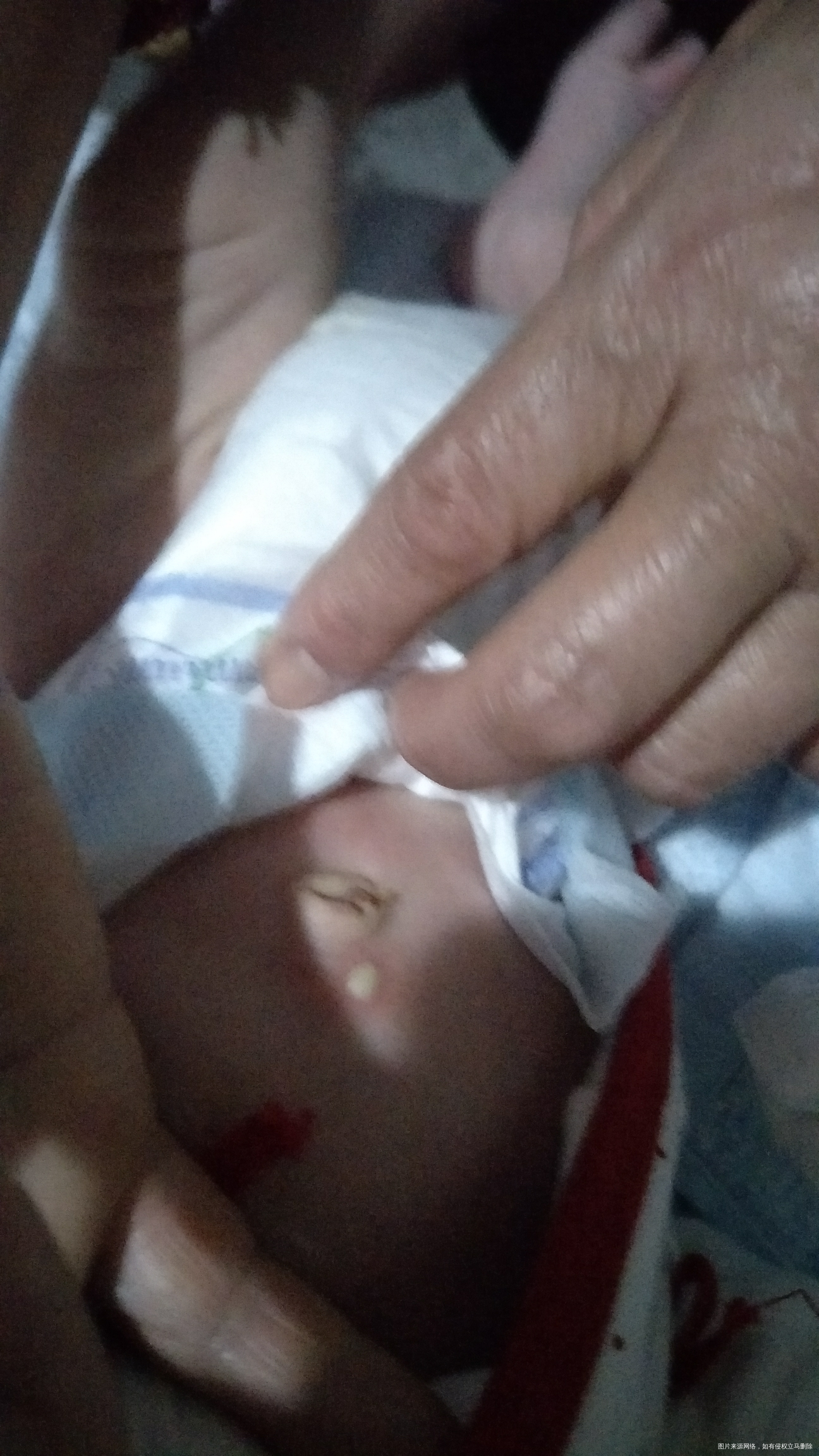 麻烦医生给看看宝宝肚子上长了个痘痘