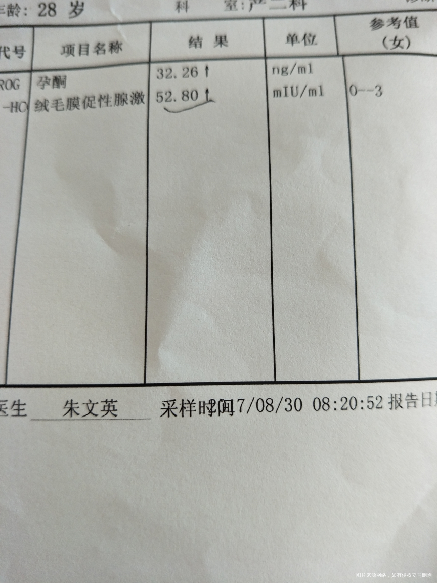 刚刚怀孕,因之前胎停育,很是紧张😰