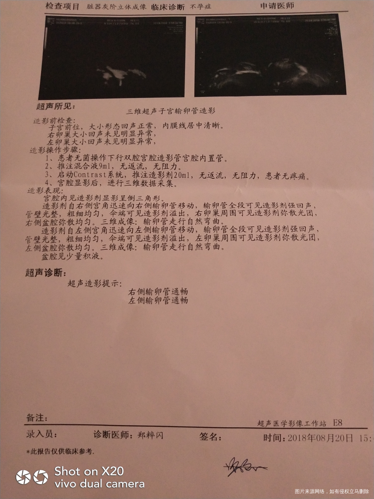 8月22日,星期三,阴
今天早晨起来收拾好就去医院,去到三楼刷卡,等待喊名字,等…