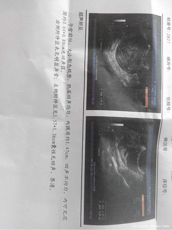 医生帮我看看超声单正常吗?