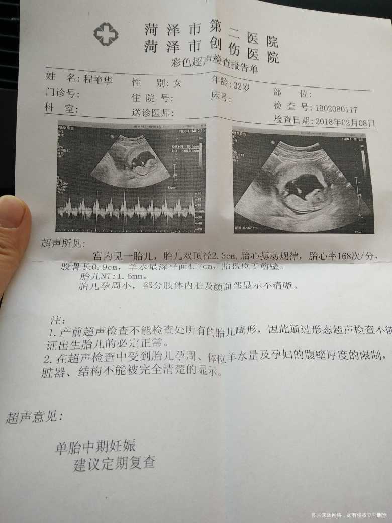 孕12周+3天查的nt