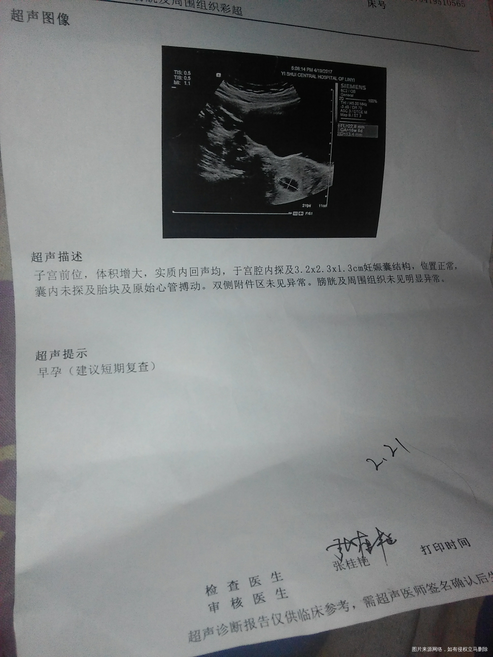 系统显示怀孕8周了,我末次月经是2.21日