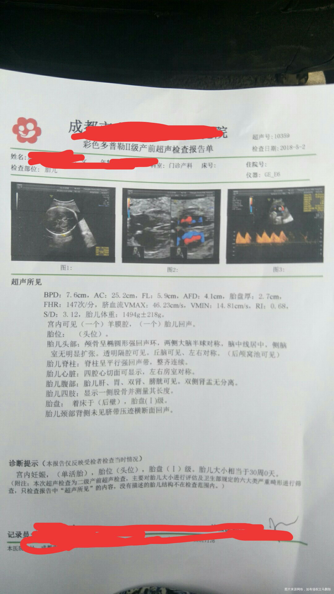 今天刚做的二维,请帮忙看看报告
