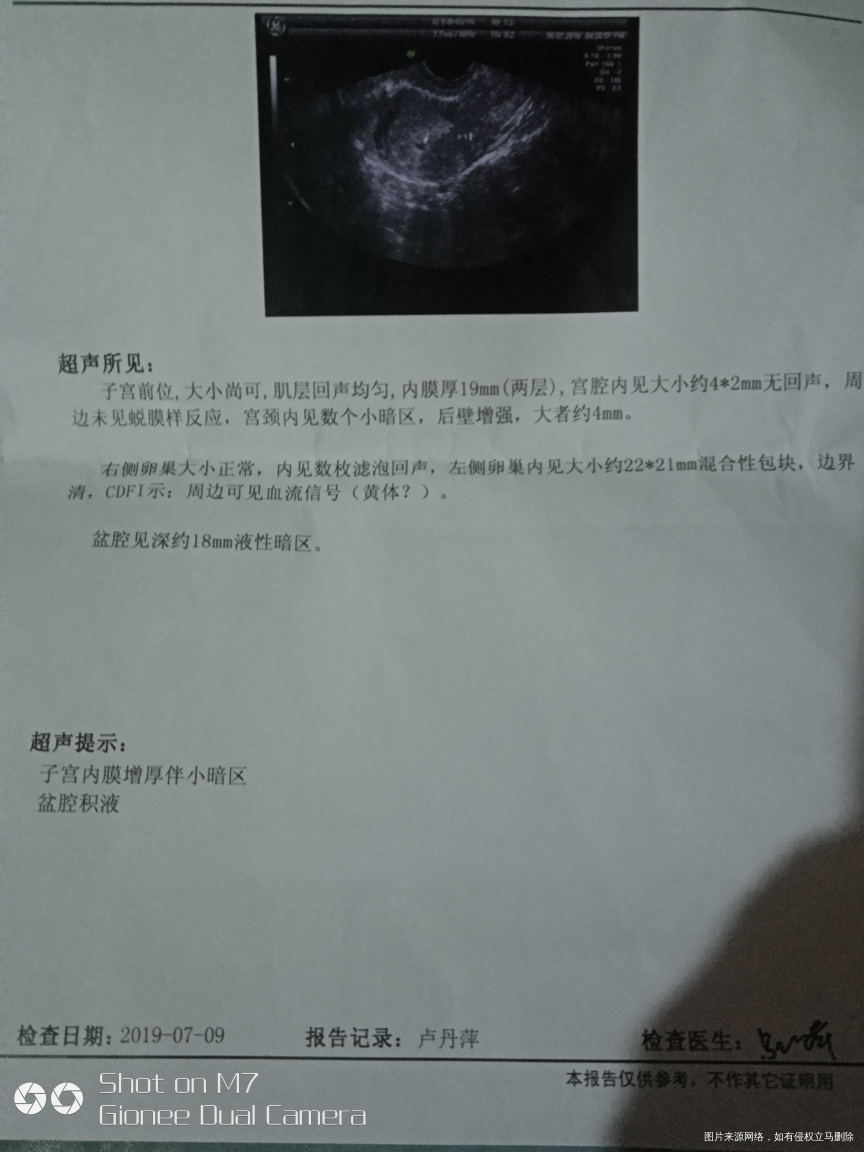 急,麻烦在线医生帮我看看