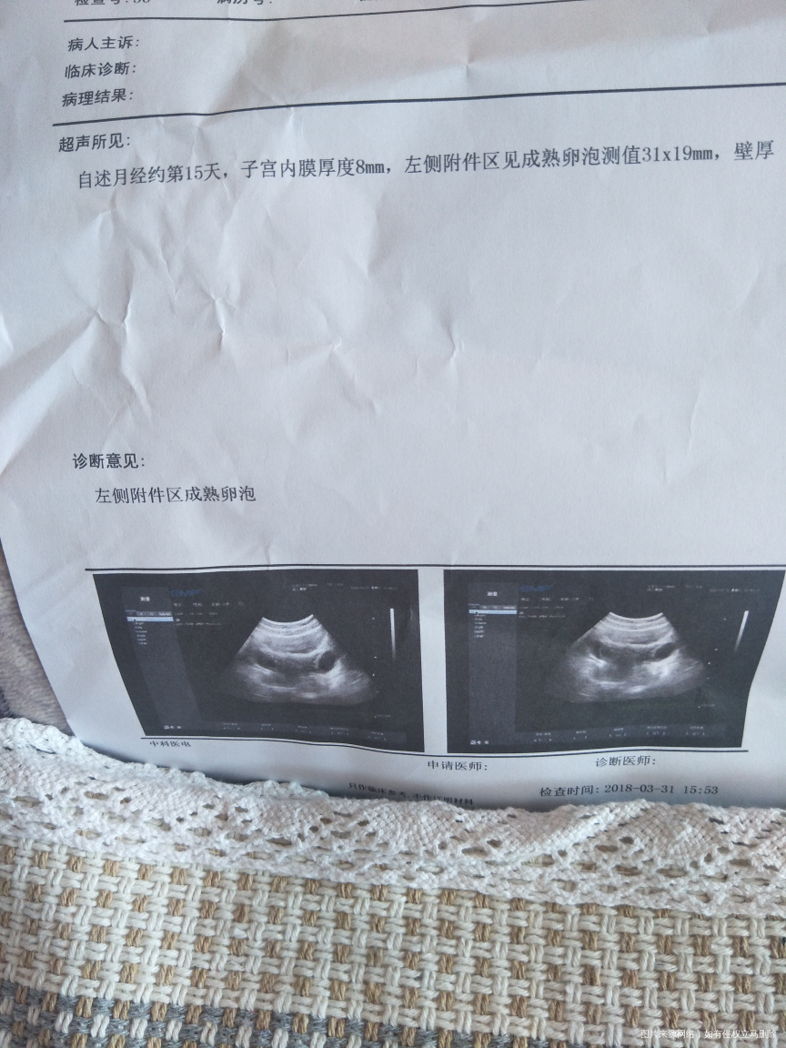 今天肚子疼去做比超 竟然这样