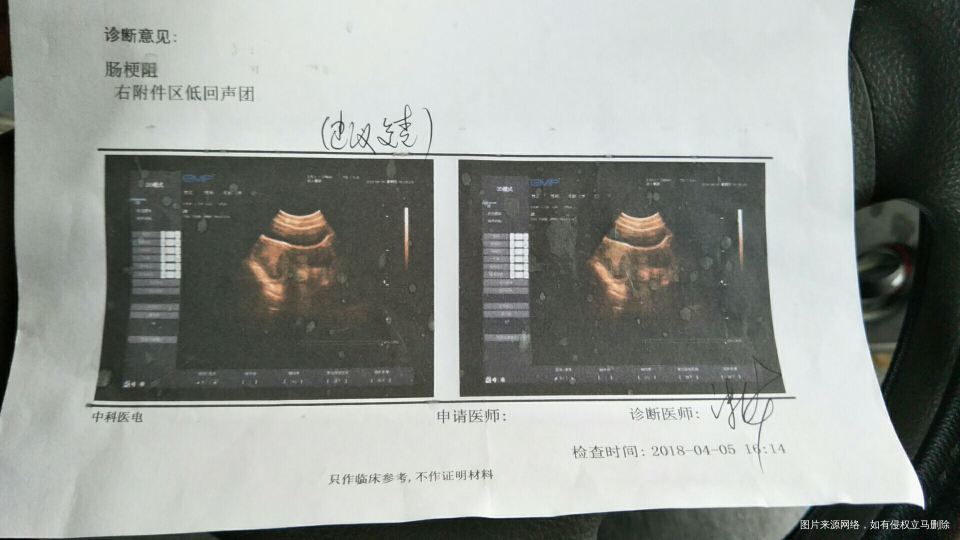 今天肚子疼去做比超 竟然这样