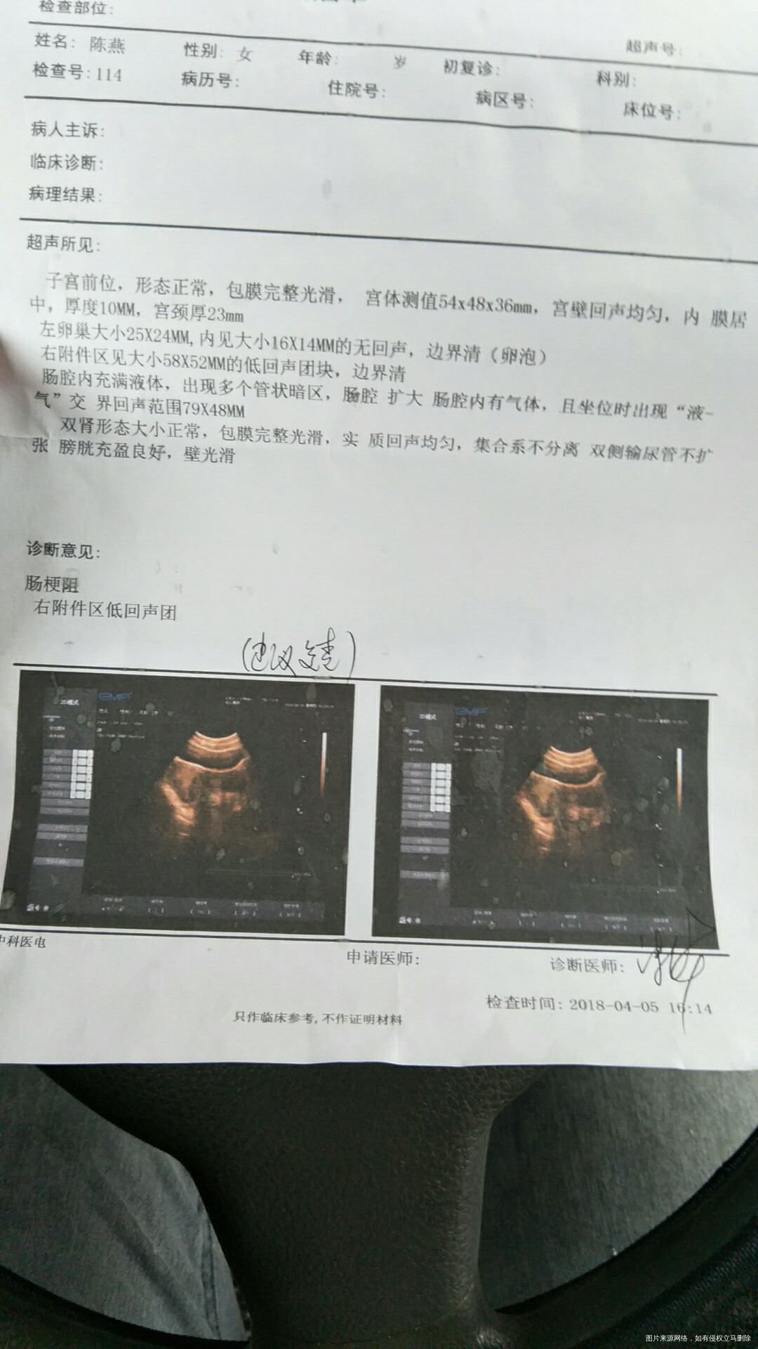 今天肚子疼去做比超 竟然这样