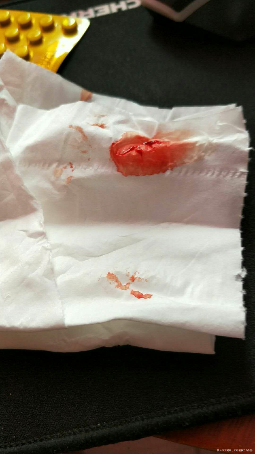 怀孕11周 昨天下午上街热了 吊了两天吊针,刚才咳出血