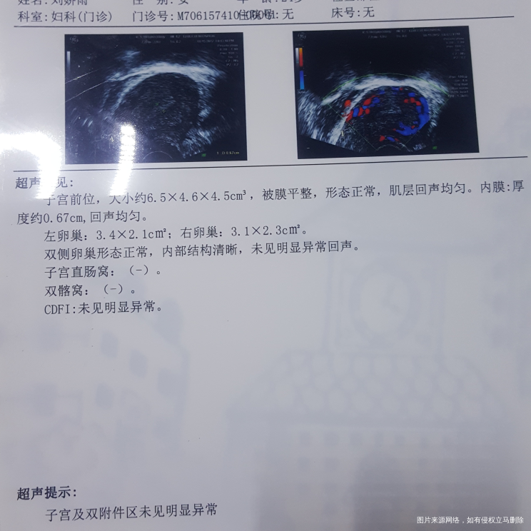 .大夫说是先兆流产了,有宫外孕的可能吗?