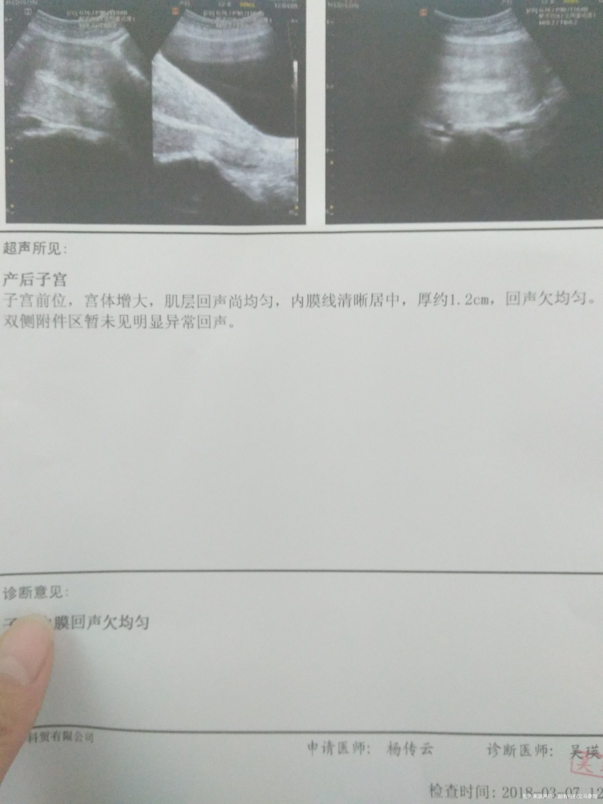 有医生在吗生宝宝3天复查的BC