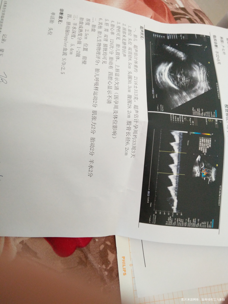 刚刚做的检查,求助医生帮忙看看问题大不大