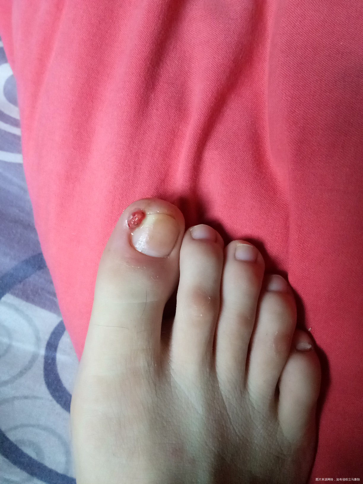 麻烦医生看看,我该怎么办