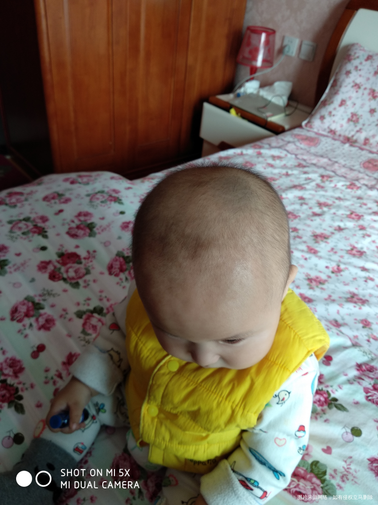 麻烦在线的医生看看,谢谢!