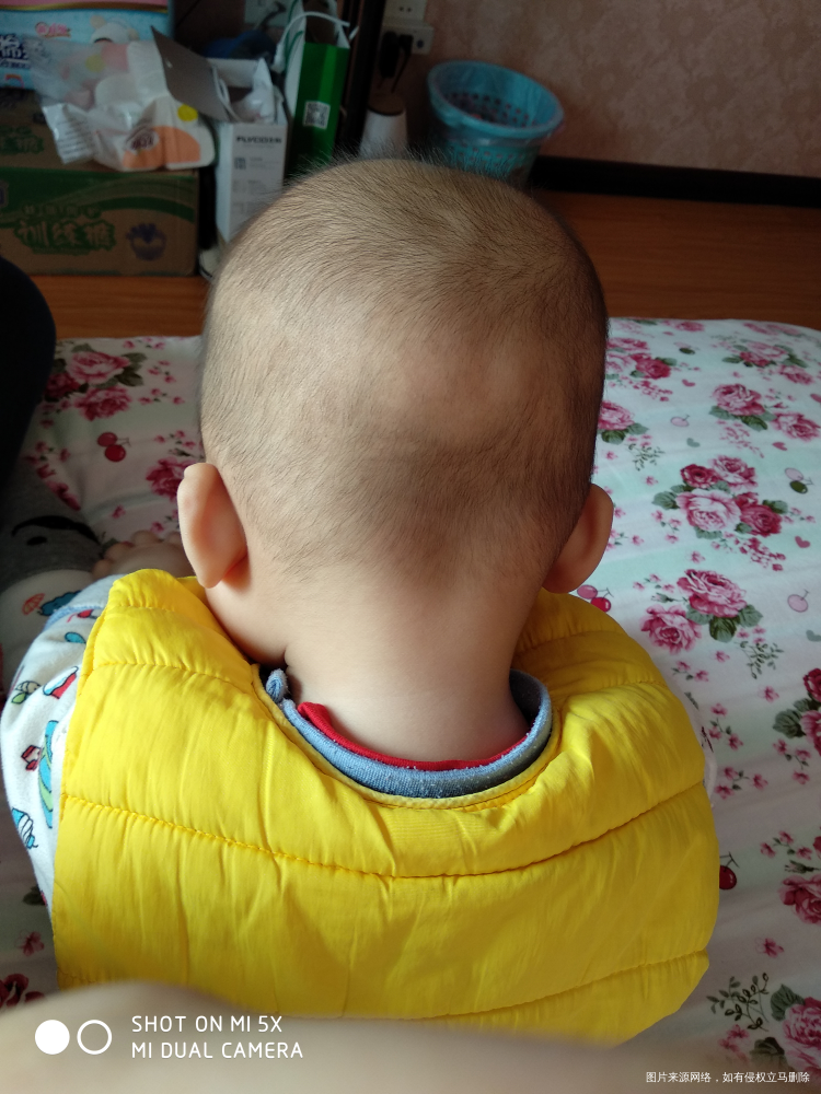 麻烦在线的医生看看,谢谢!