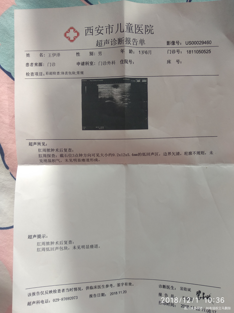 肛周脓肿术后表皮有脓怎么办