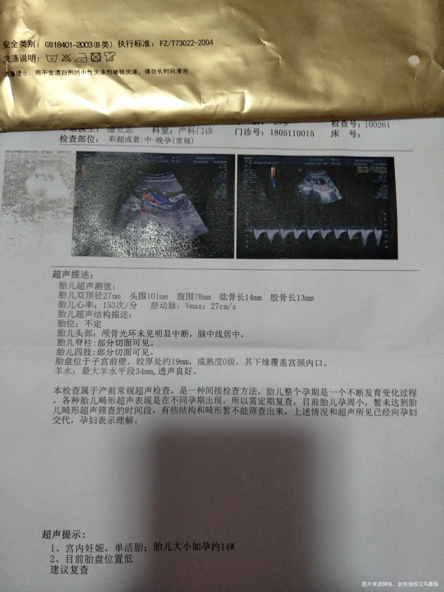 医生帮我看看检查结果怎么样