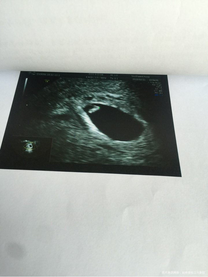 一超顺利通过…………