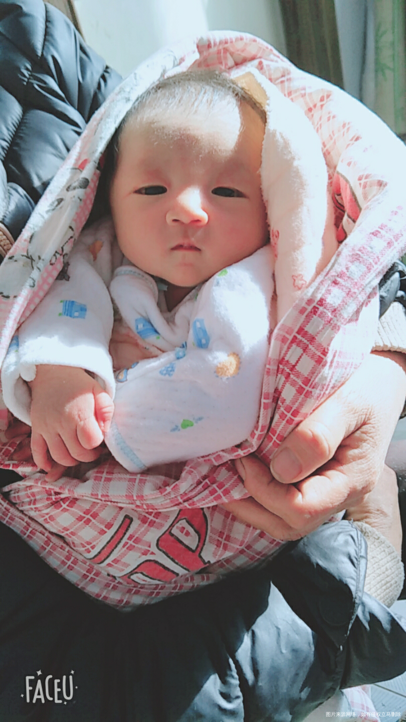 求帮助,我们宝宝眼皮红是胎记吗