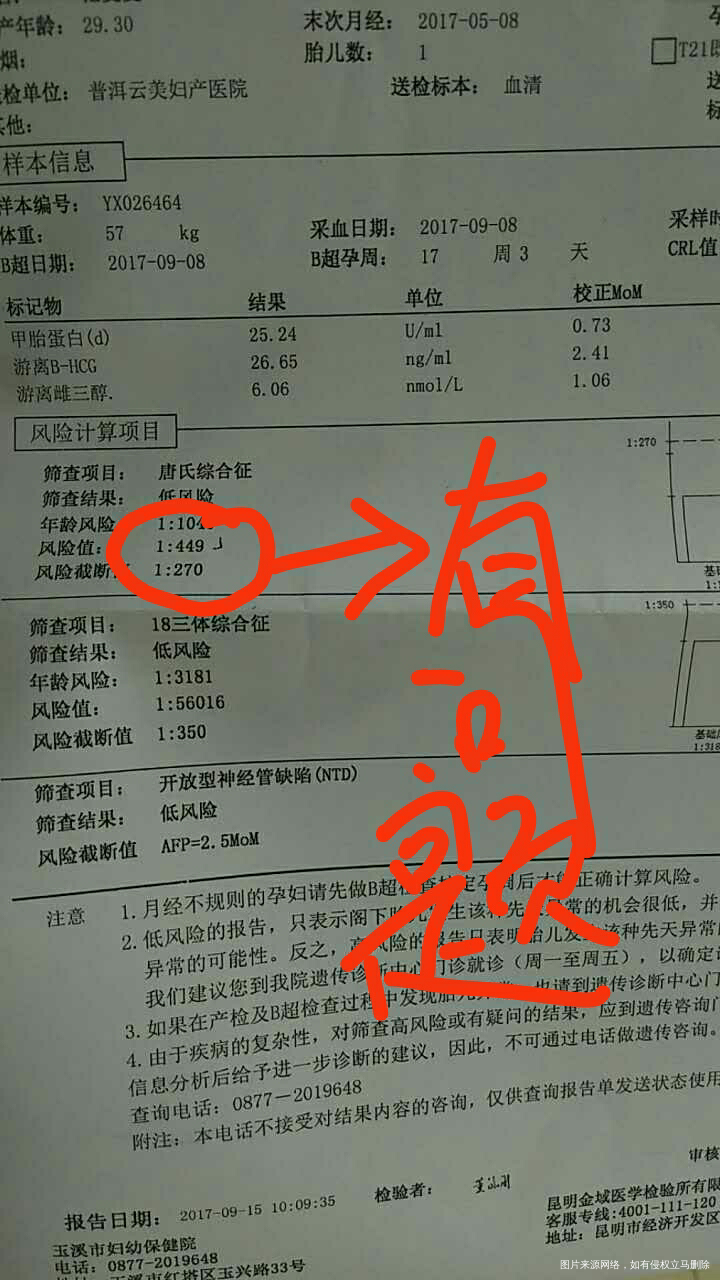 唐氏综合检查结果需要再做无创吗