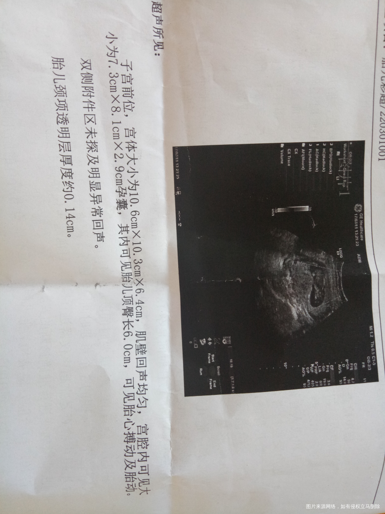 孕检,急急急急急急求助。。