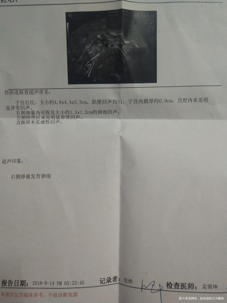 医生帮忙看一下这结果都正常么???