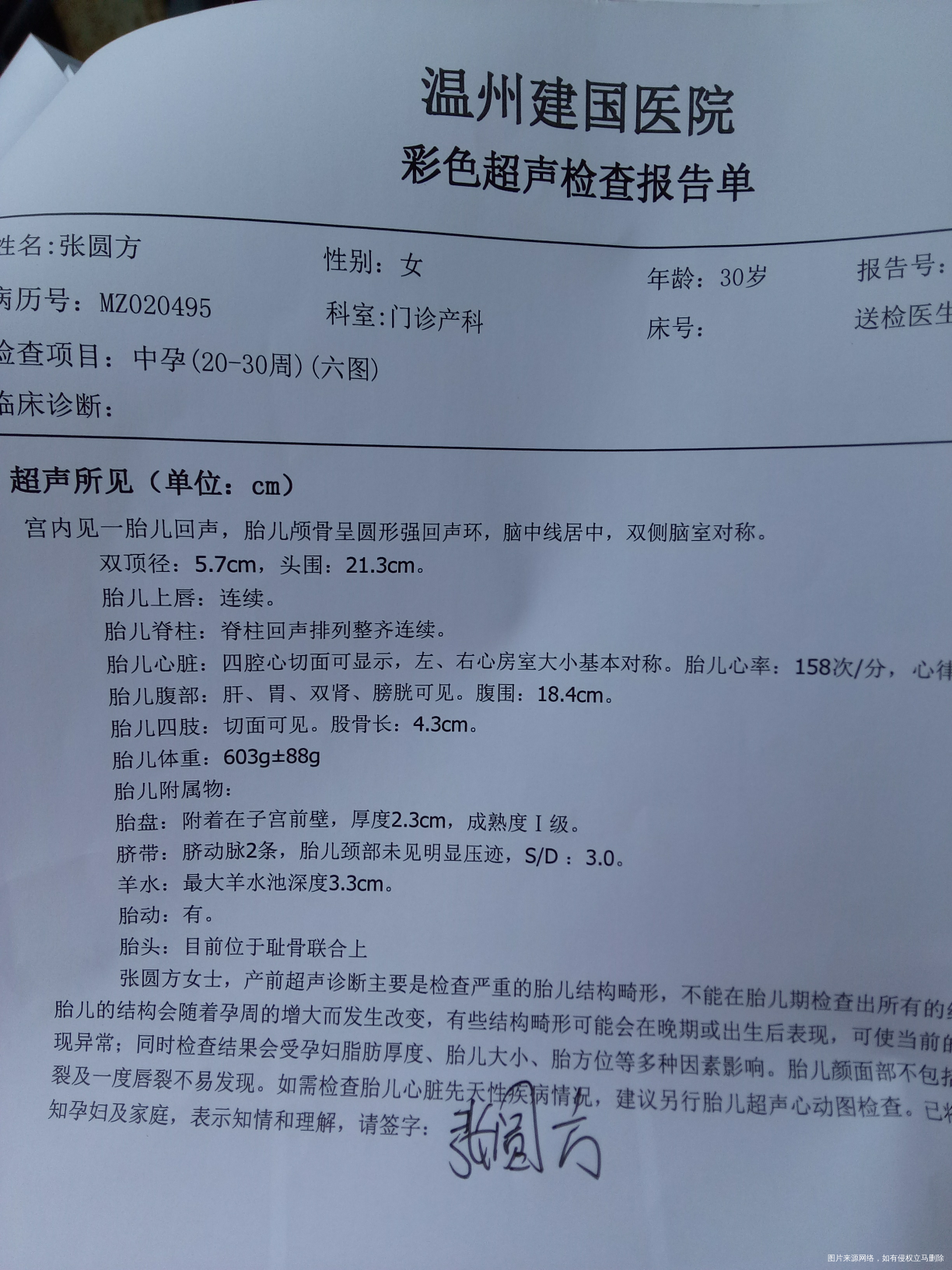 有经验的医生能帮我看看四维彩超单子是男孩子女孩吗?