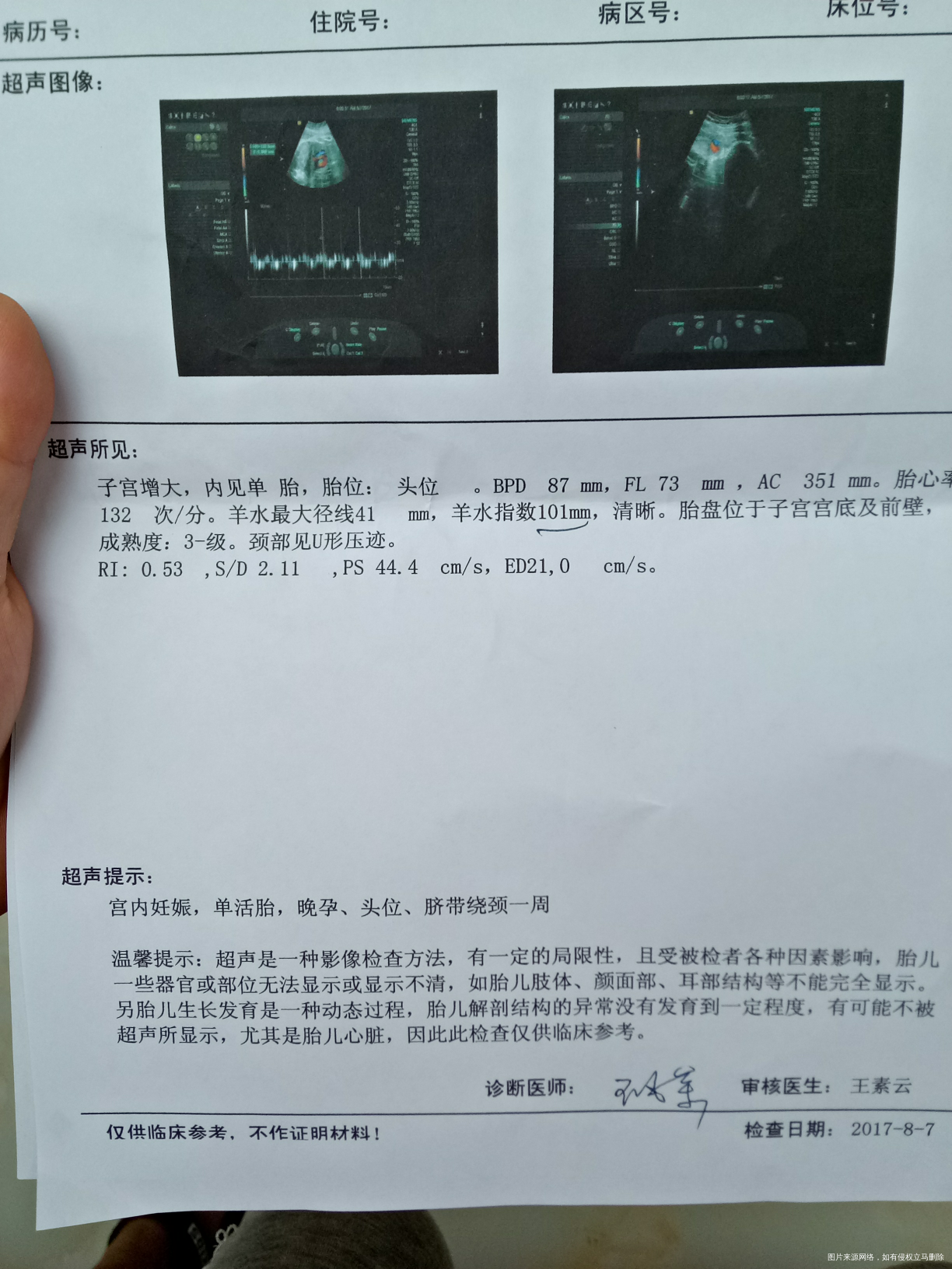 医生在线吗看看彩超单子正常吗孩子有多重了