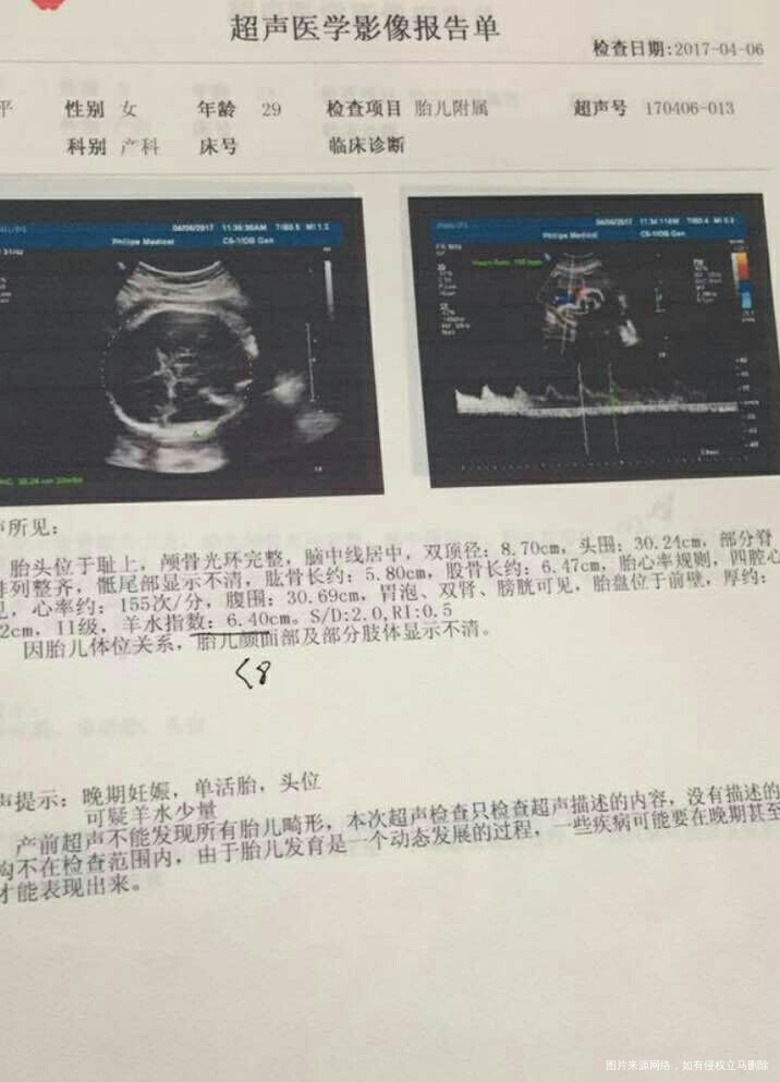 急急急,帮忙看看超声检查报告单,正常吗?