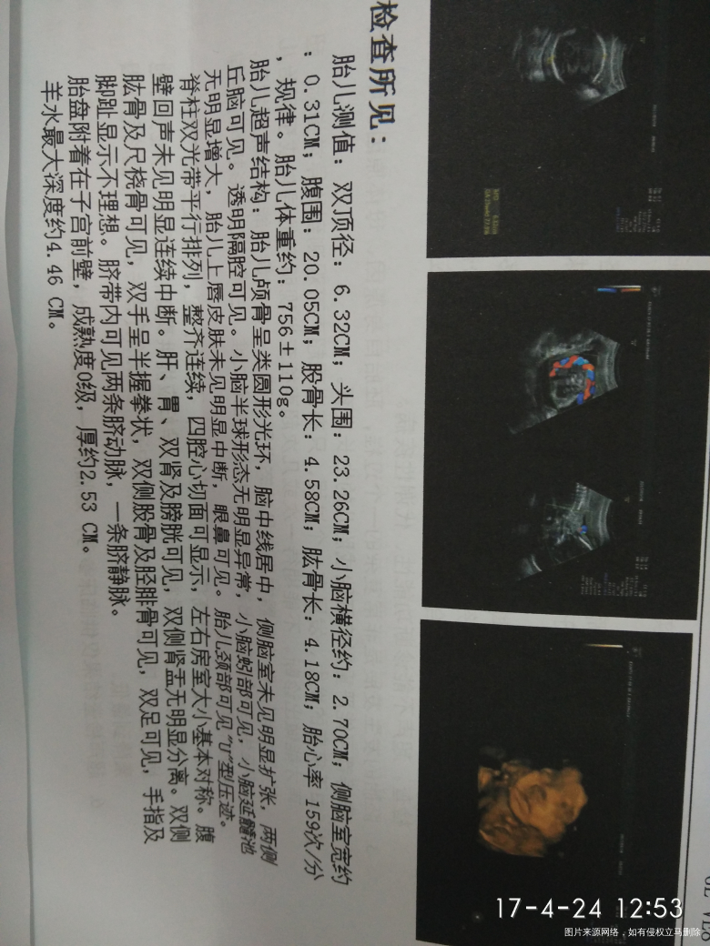 帮忙看看四维超声都正常吗?谢谢