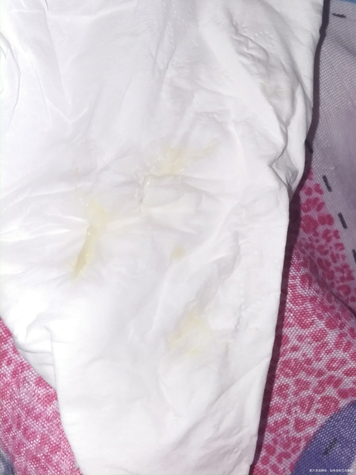 有个问题想请教下各位医生???