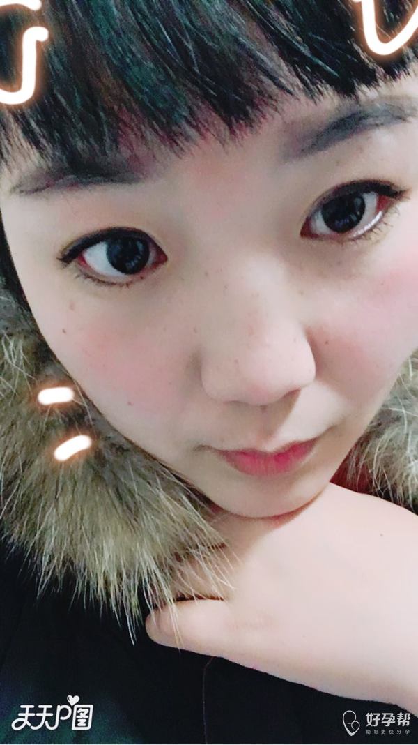 这个刘海被剪的丑炸了