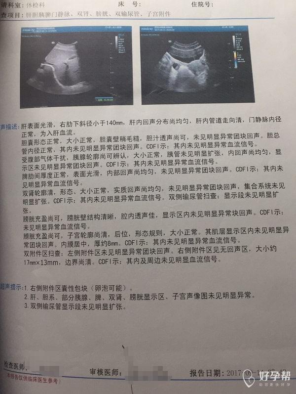 我这到底是子宫前位还是后位?两次体检不一样