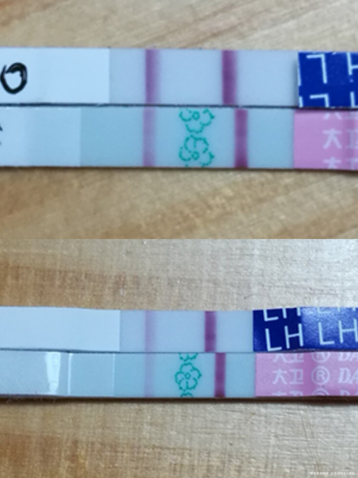 医生,请帮我看看这是什么情况呀