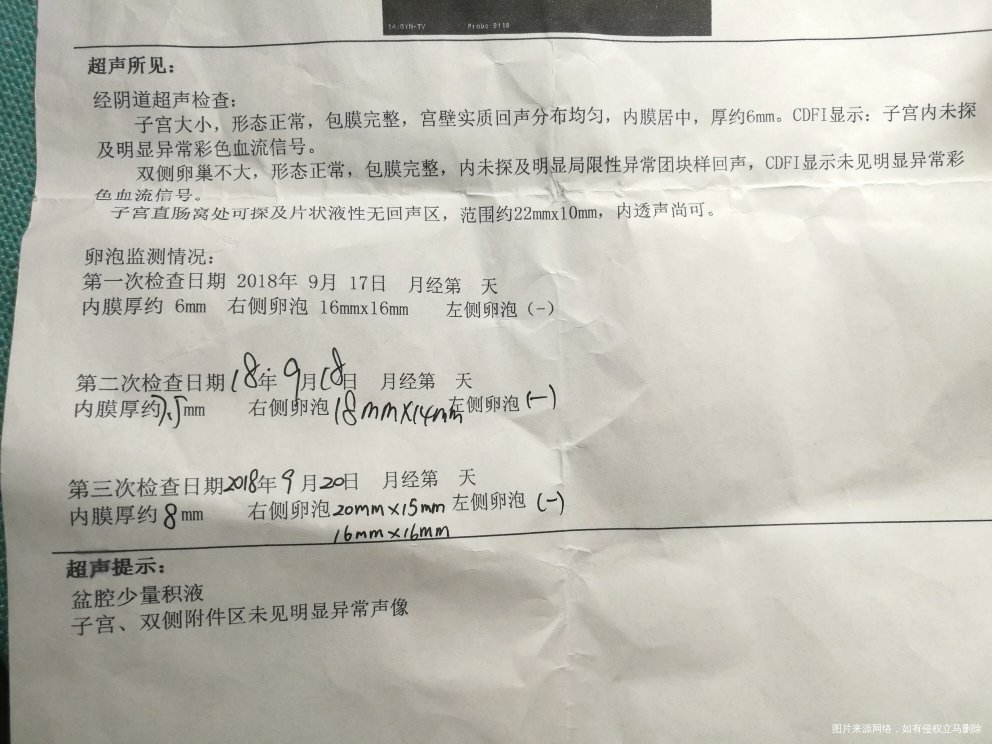 今天阴超,有一个都20*15了为什么试纸还是很淡?试纸有问题吧