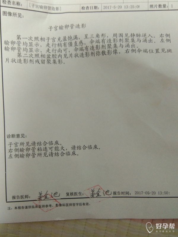 求助医生帮我看看输卵管造影片子