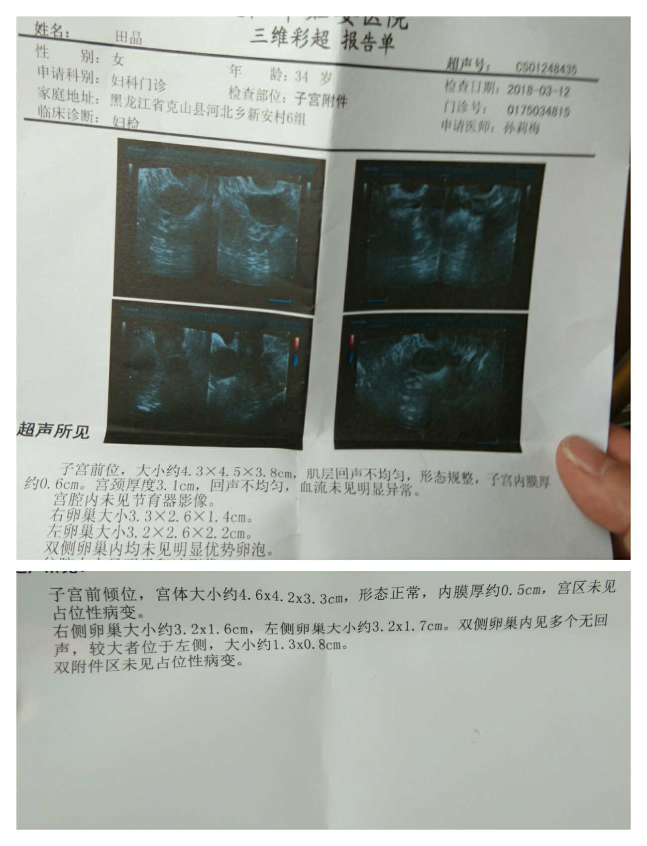 医生帮我看看排卵监测单子急急急