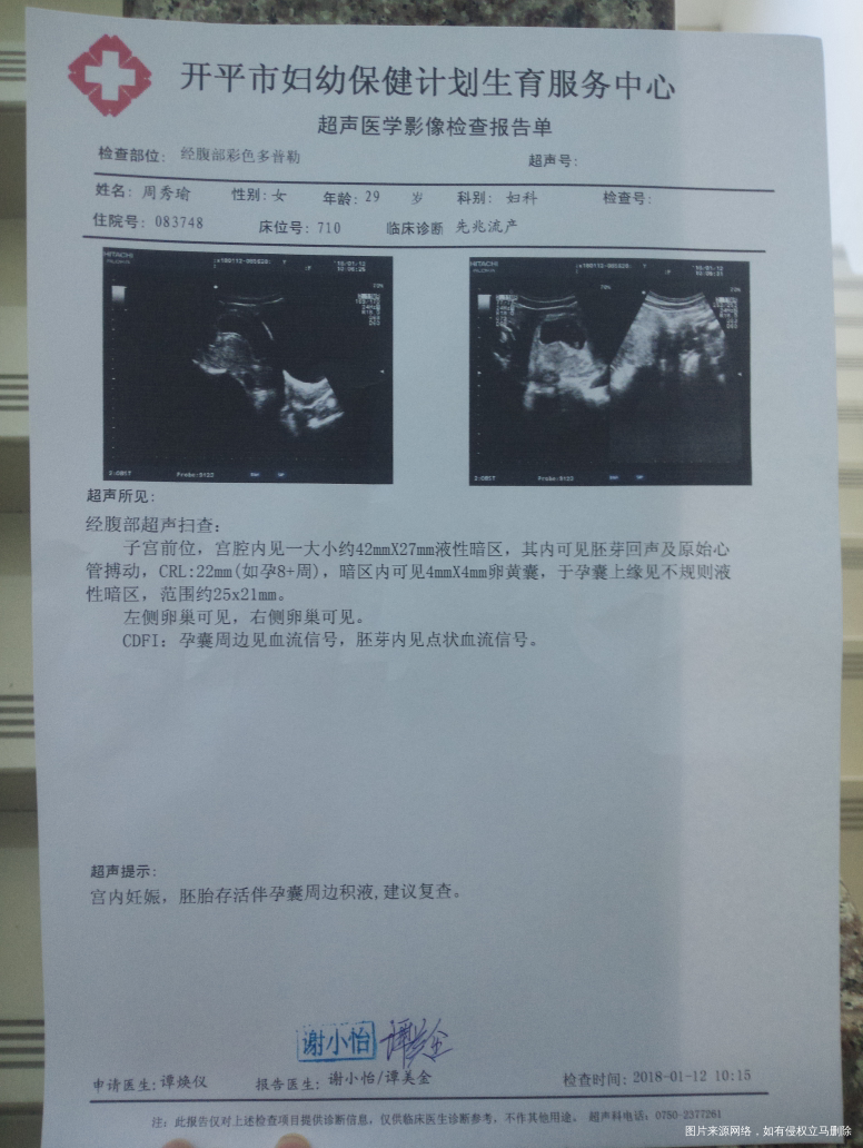 怀孕9周肚子针扎痛,担心…