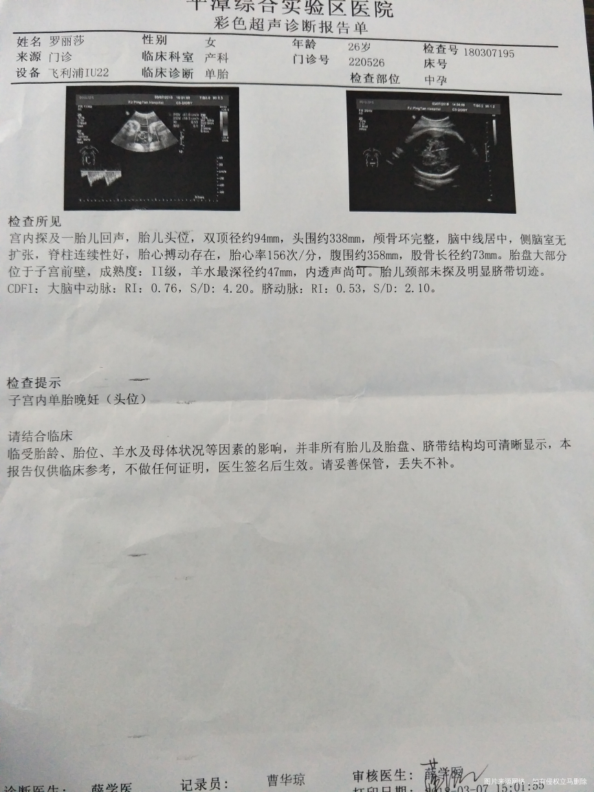 请帮我看看这是不是羊水破了