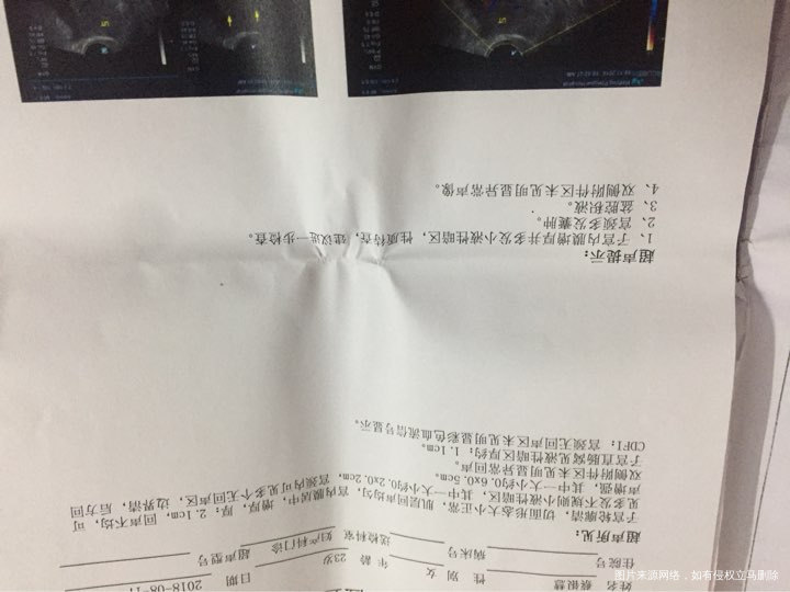 请医生帮我看看是怎么回事