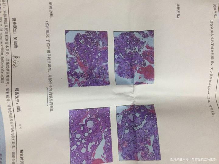 请医生帮我看看是怎么回事