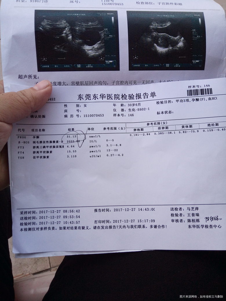 会看的宝妈请帮忙看看。
今天下午拿了,验血单,说孕酮低