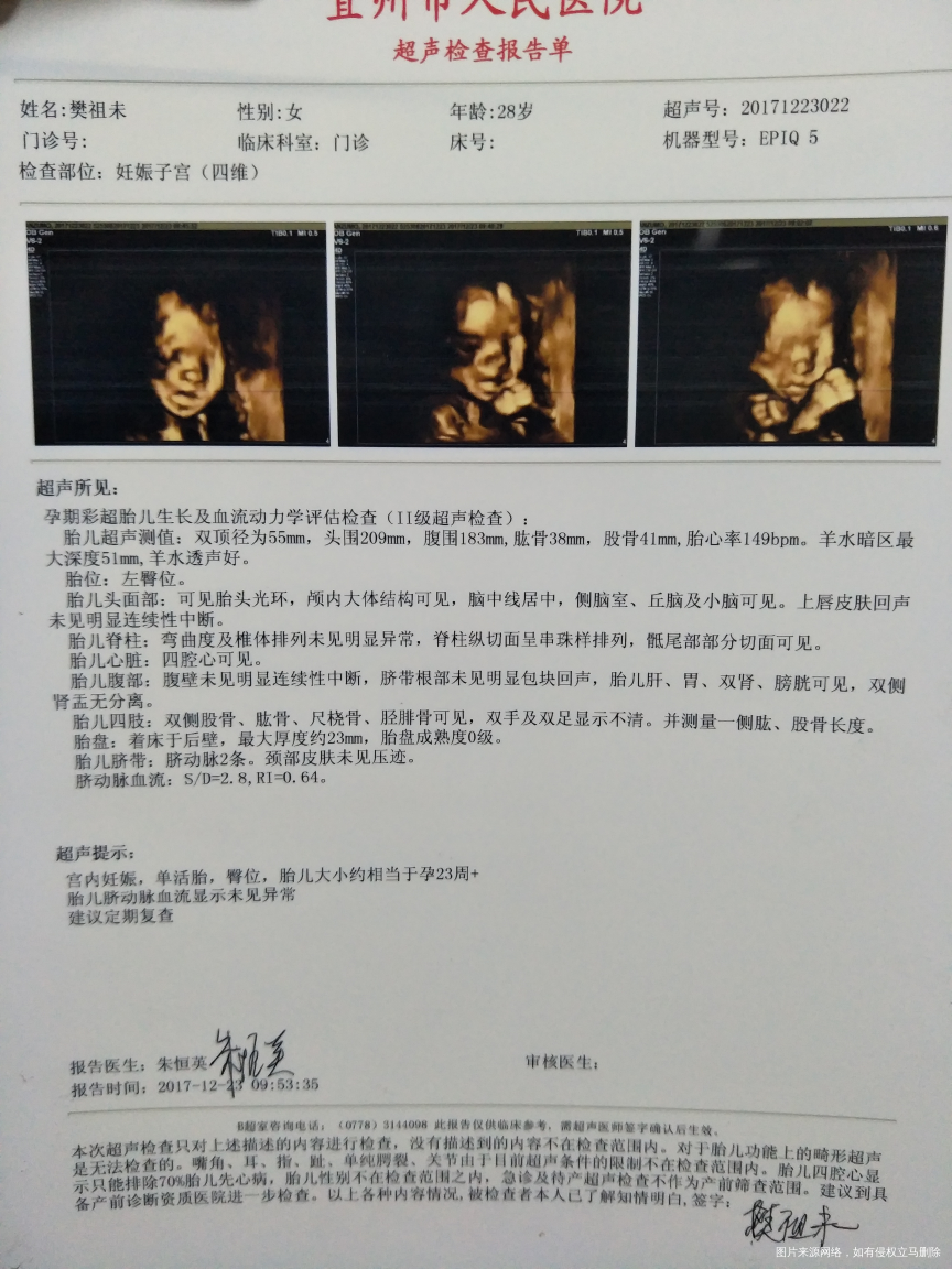 感谢宝宝这么配合,四维一次通过