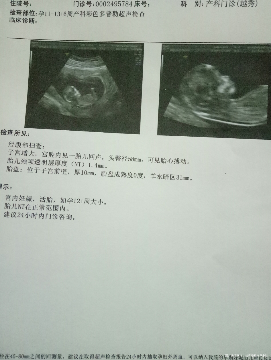 NT回来,宝宝超配合,5分钟做完