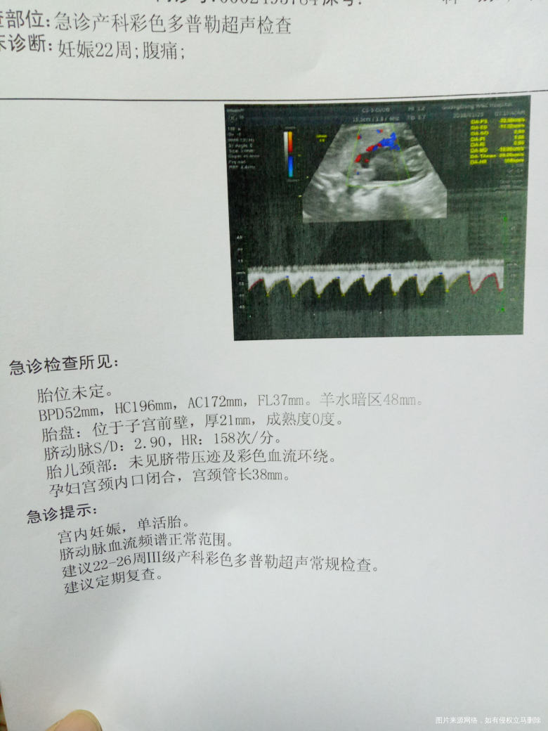 医生帮忙看看B超结果符不符合孕周