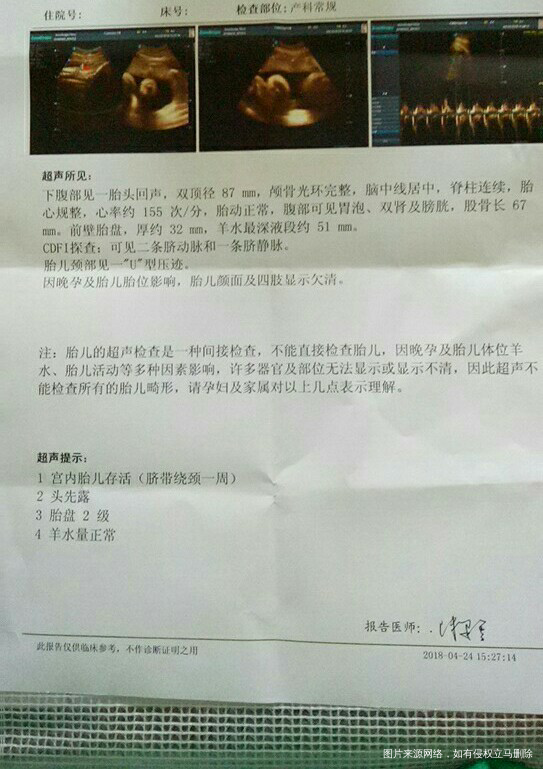 今天35周,昨天熟人医生查一下B超,麻烦看下,谢谢